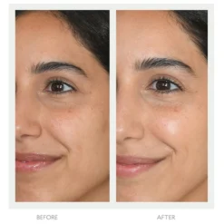 Resurfacing Mask - Masque Peeling éclat -Default Template 1 108 209647 4 max