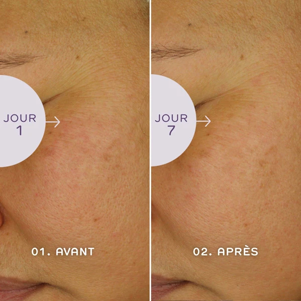 Ren Bio Retinoïd Sérum Jeunesse 3 Ren Bio Retinoïd Sérum Jeunesse – Image 3